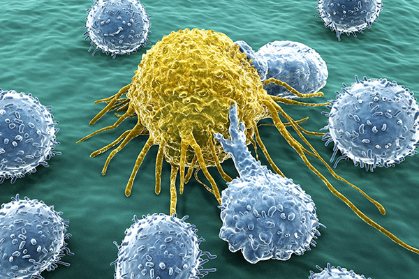 3x2_600x400_Cancer_Attacking_Cell-Carcinogenesis_us_en_web.jpg